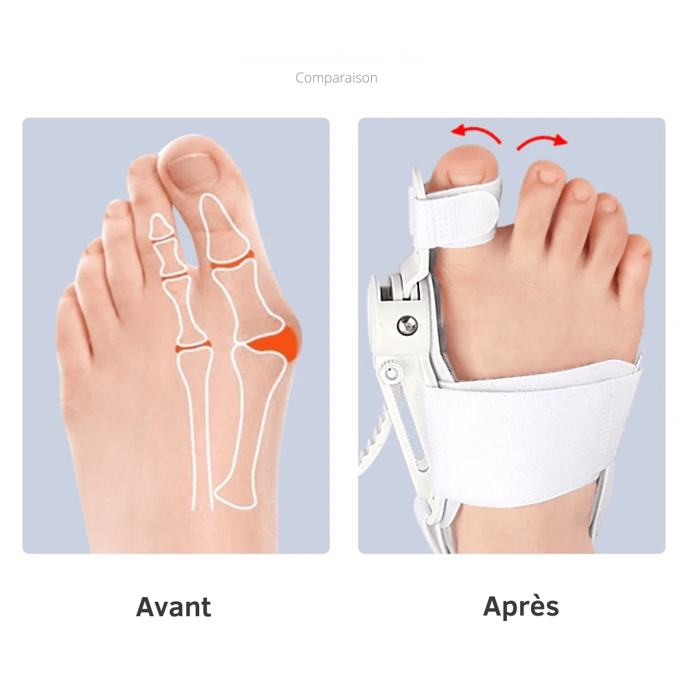 Adjustable Orthopedic Socks for Men with Big Toe Strap – view 4