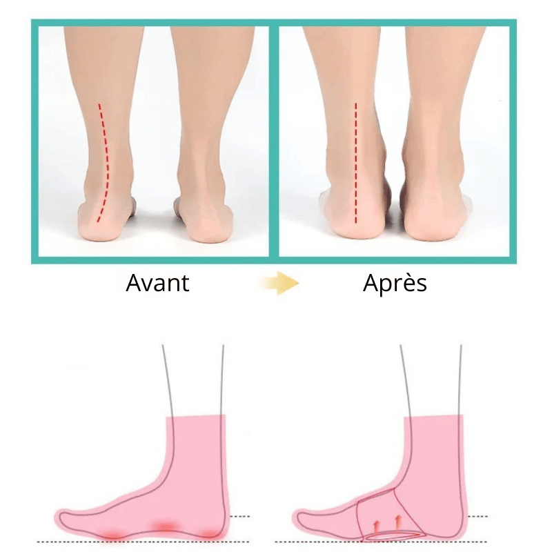 4-Piece Silicone Arch Pad Insoles for Plantar Fasciitis – view 3